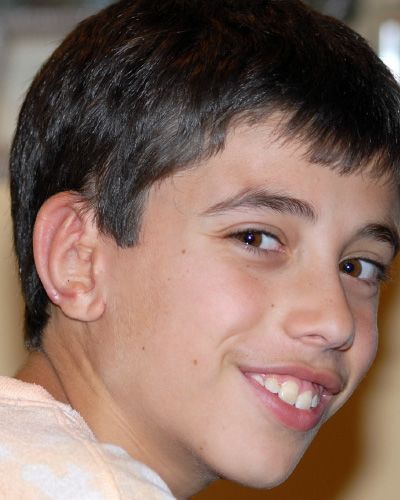 right ear reconstruction after